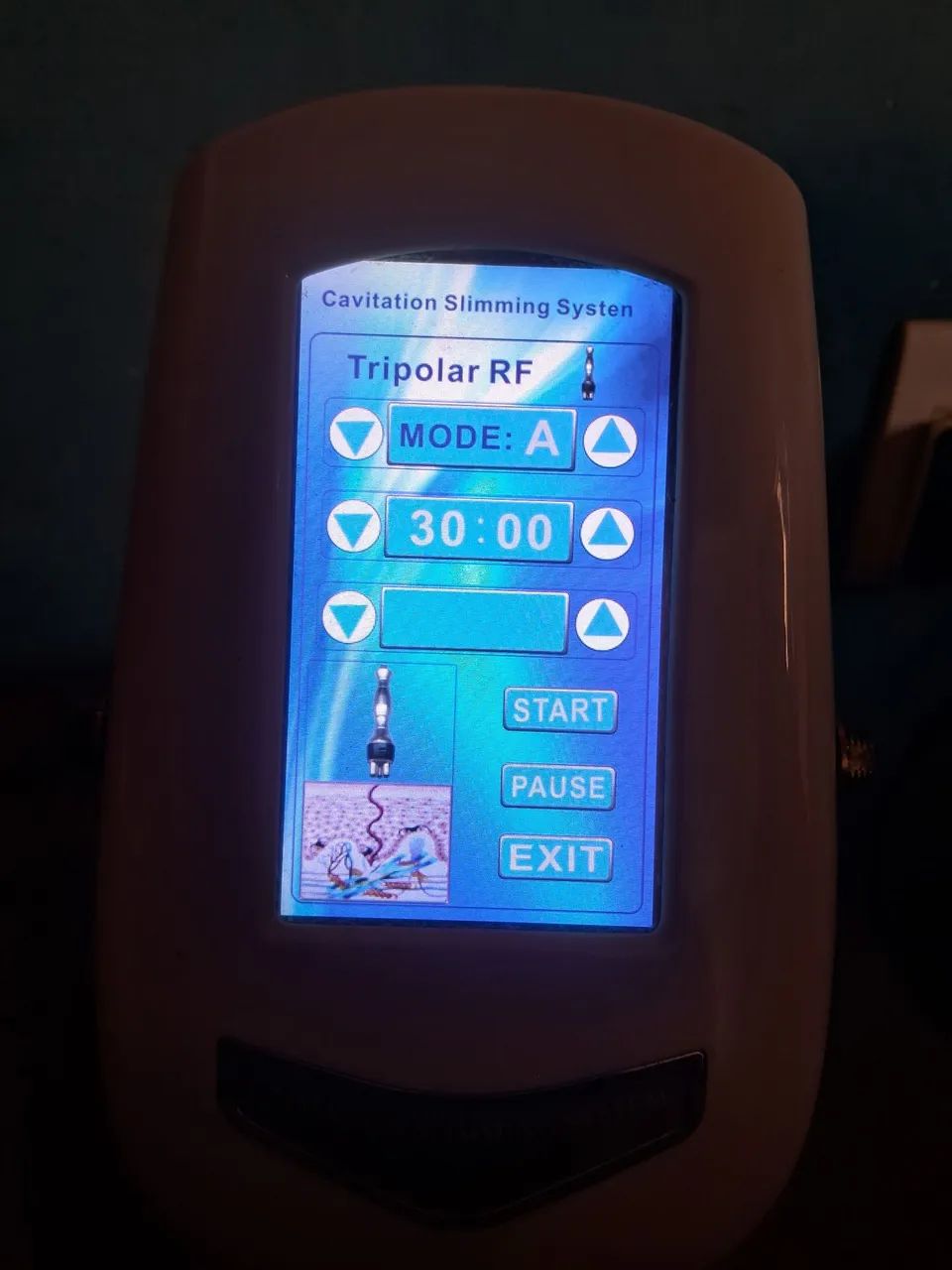 Aparelho de massagem  - Foto 5