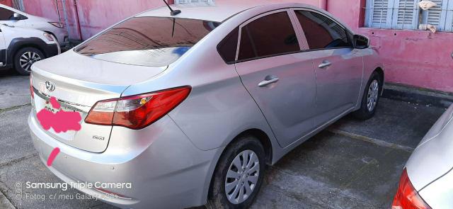 HB20S valor R$ 30.00000