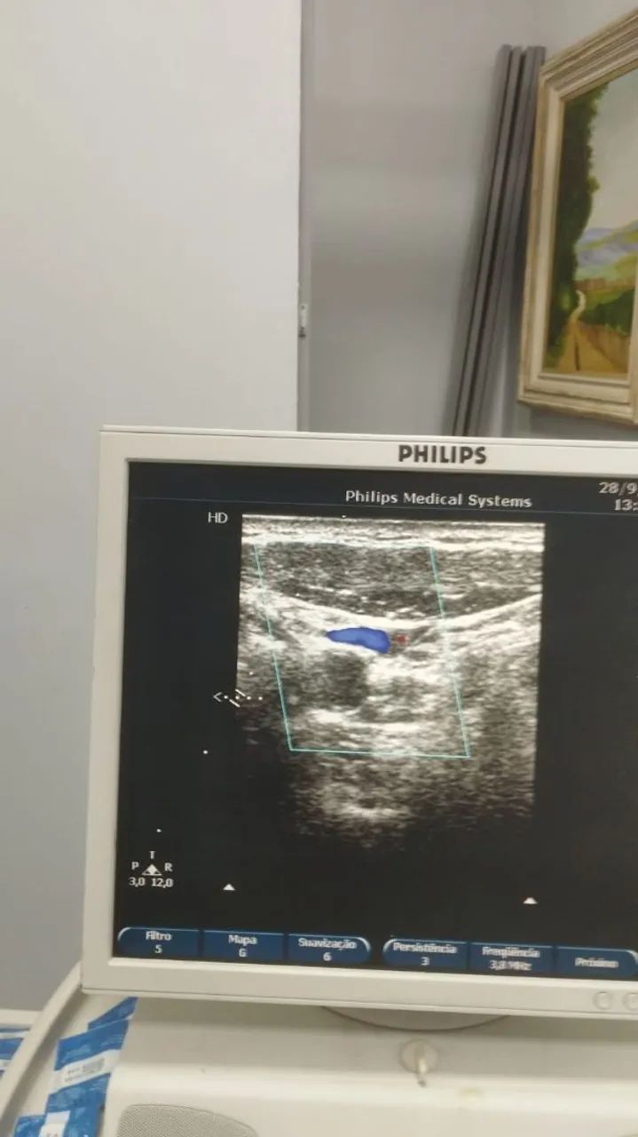 ULTRASSOM PHILIPS EnVISOR  - Foto 4