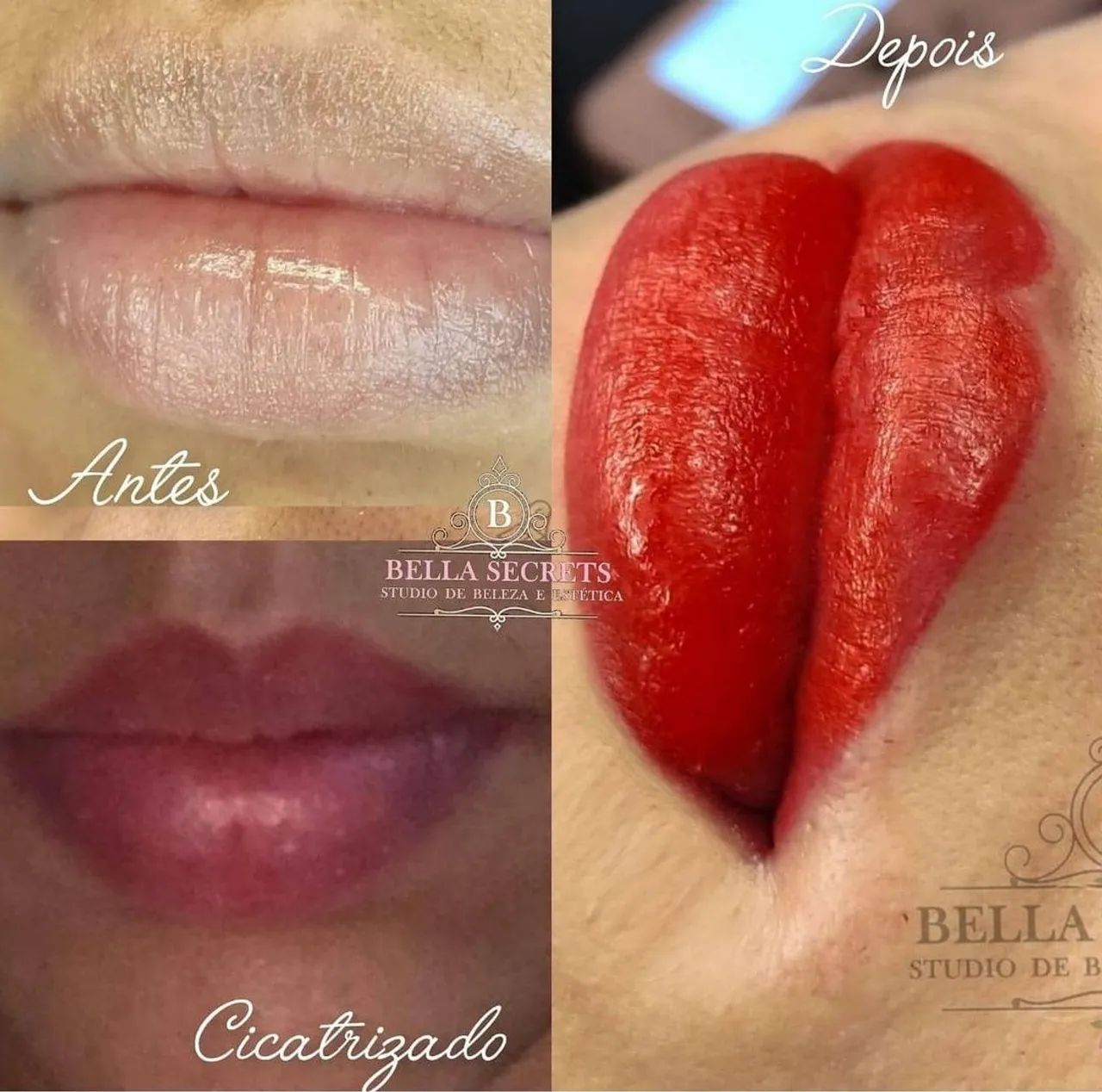 Micropigmentação Labial expert  - Foto 5