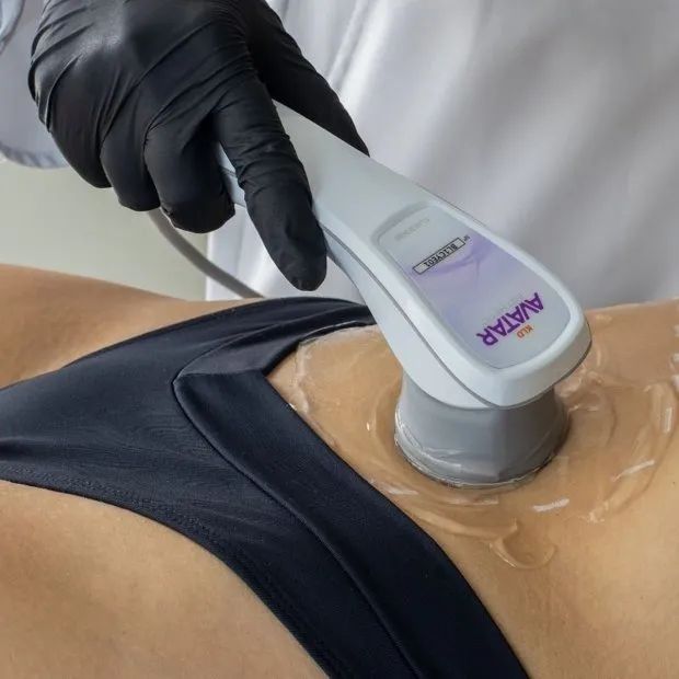 Equipamento de saúde e estética - Foto 4