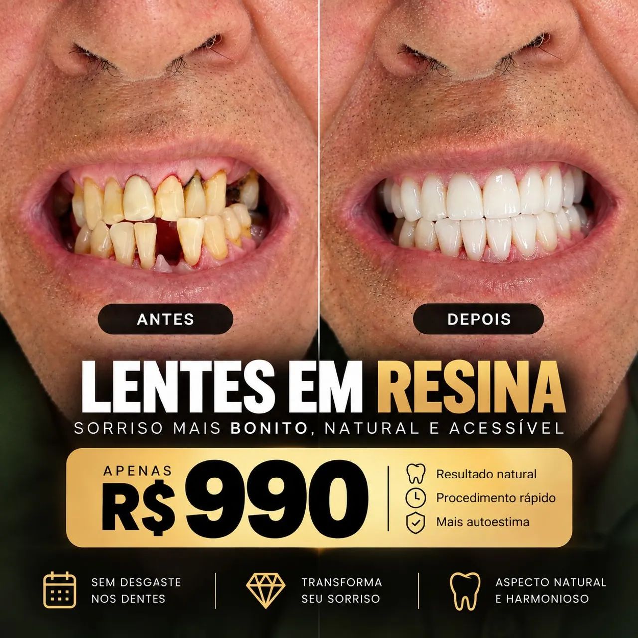 10 LENTES EM RESINA  - Foto 2
