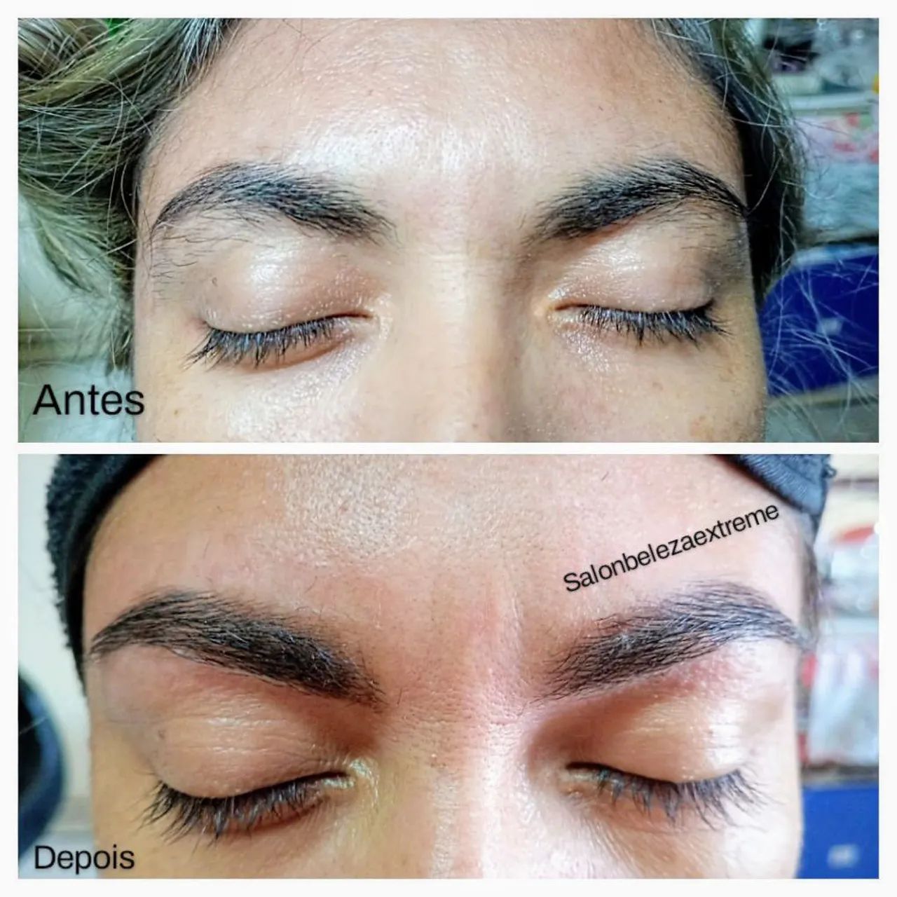 Estética avançada e completa.  - Foto 5