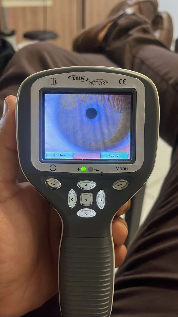 Retinografo portátil  - Foto 2