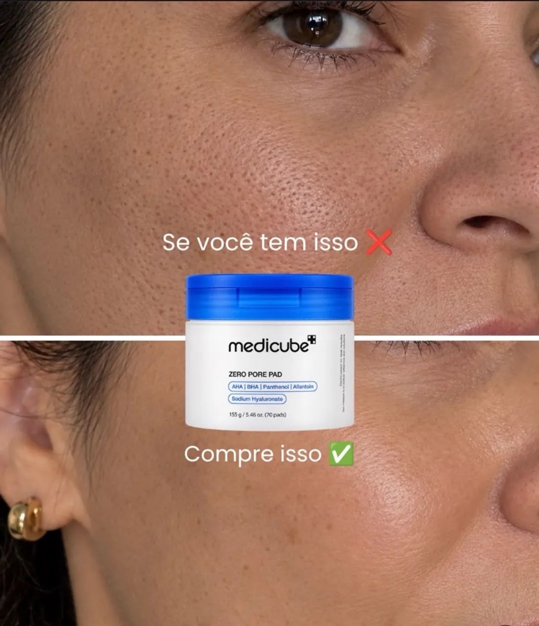 Medicube Zero Pore Pad - Foto 2