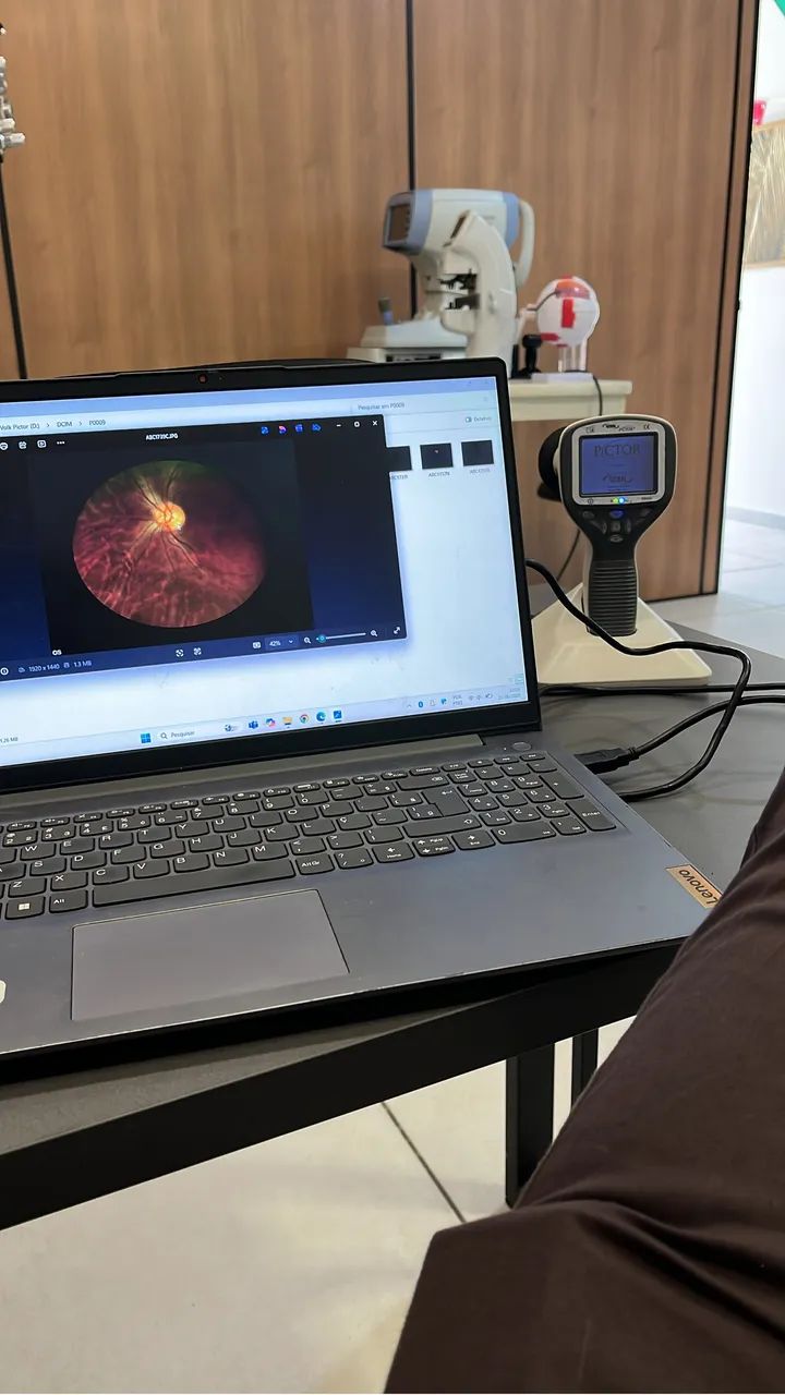 Retinografo portátil  - Foto 3