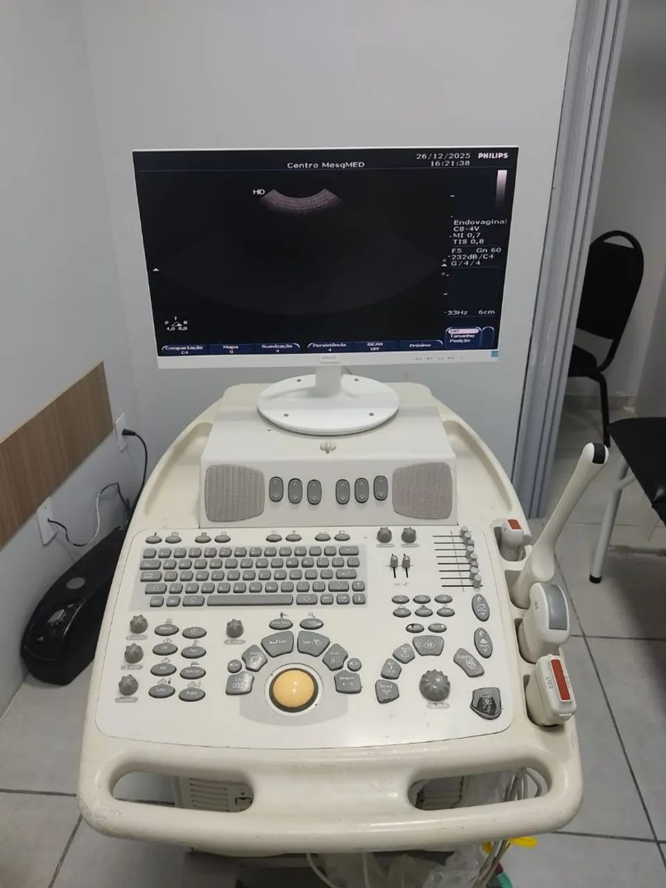 ULTRASSOM PHILIPS EnVISOR  - Foto 5