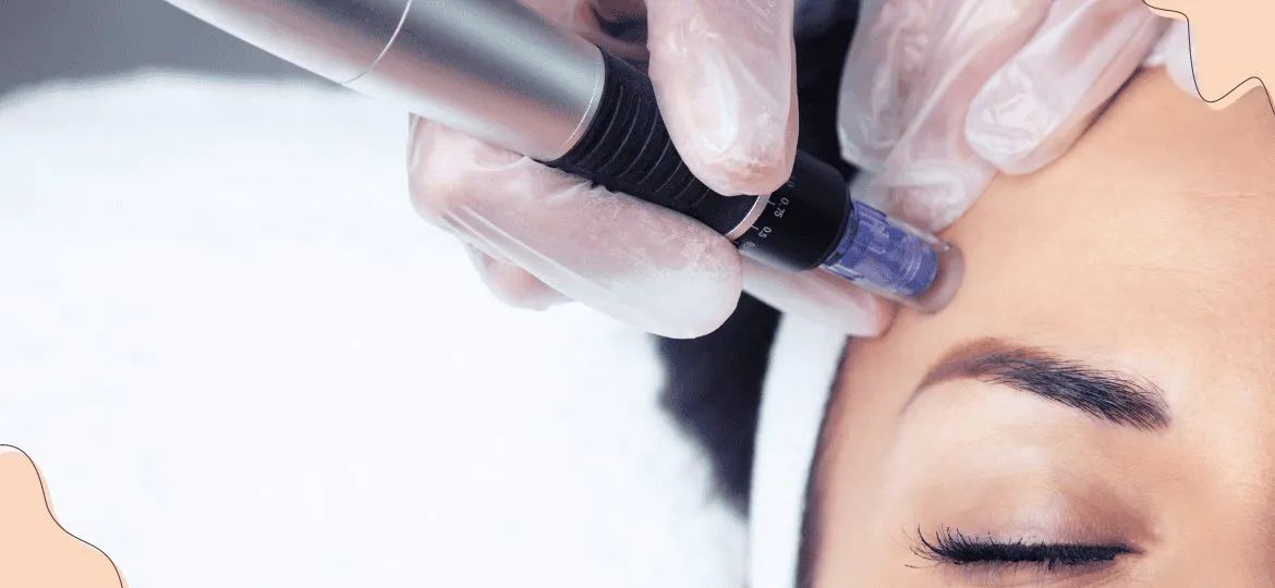 Tratamentos Faciais e Corporal - Thatybeauty - Foto 4