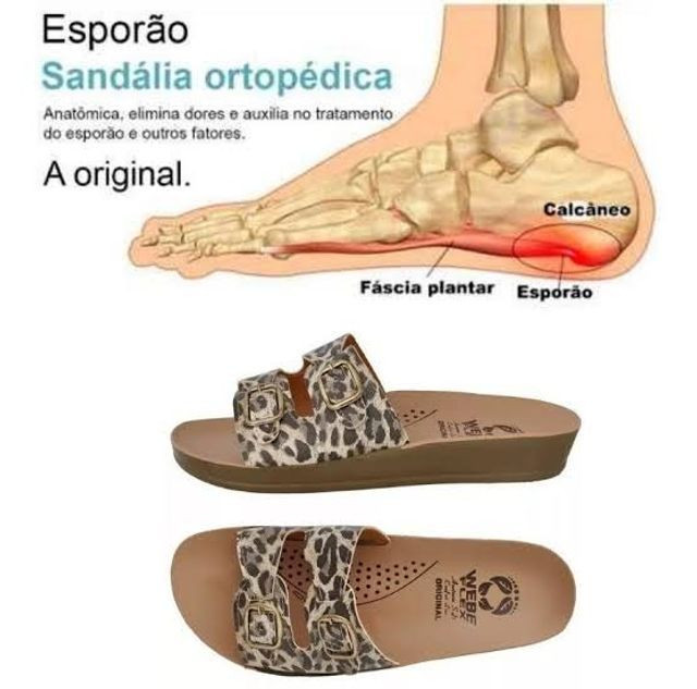 sandália ortopédica
