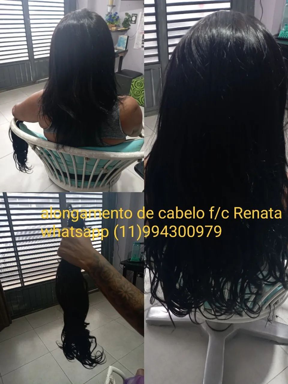 Megahista colocação de cabelo  - Foto 4
