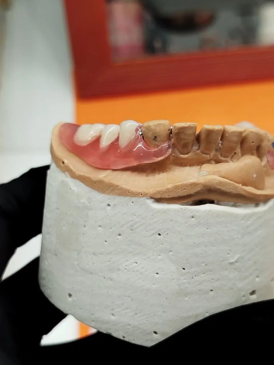 Prótese dentaria  - Foto 2