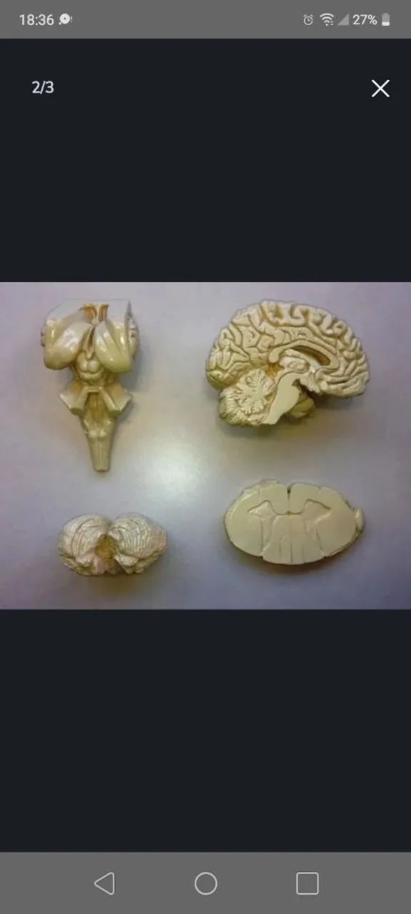 Kit para estudo de Neuroanatomia. - Foto 2