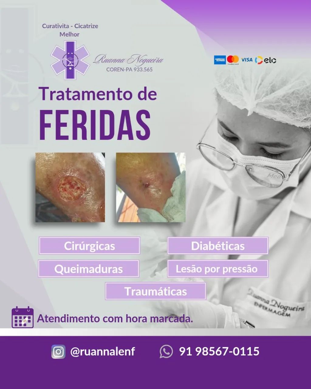 Tratamento de Feridas de Difícil Cicatrização 