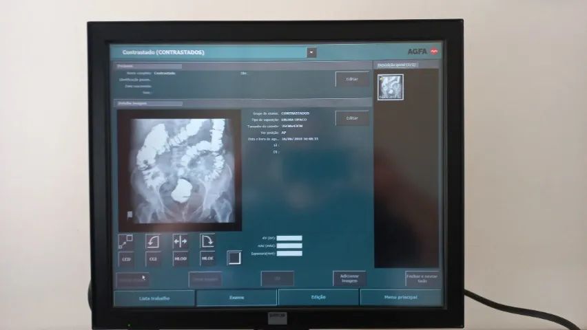 MONITOR BARCO DIACOM - Foto 3