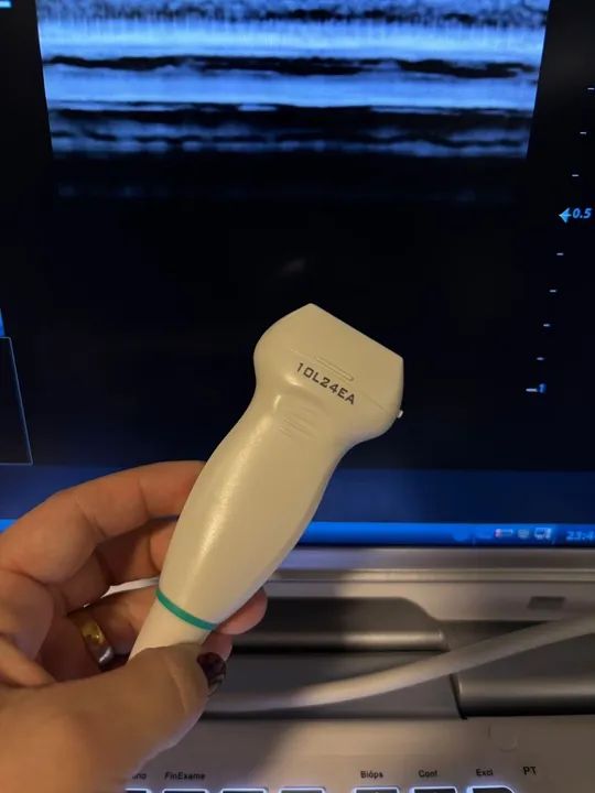 Ultrassom para diagnóstico por imagem mindray - Foto 3