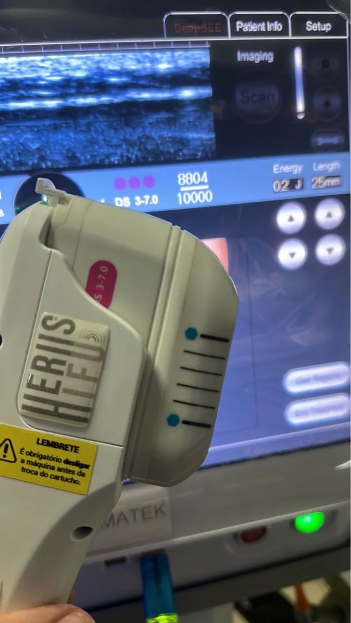 Ultrasom microfocado herus hi-fu vendo ou troco - Foto 5