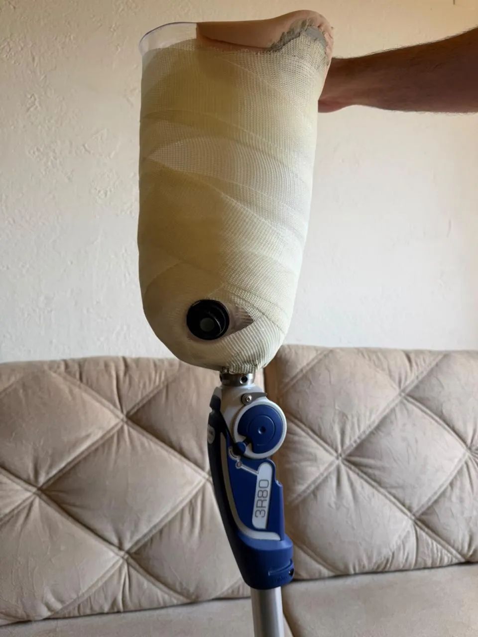 Prótese endoesqueletica para amputação transfemoral - Foto 5