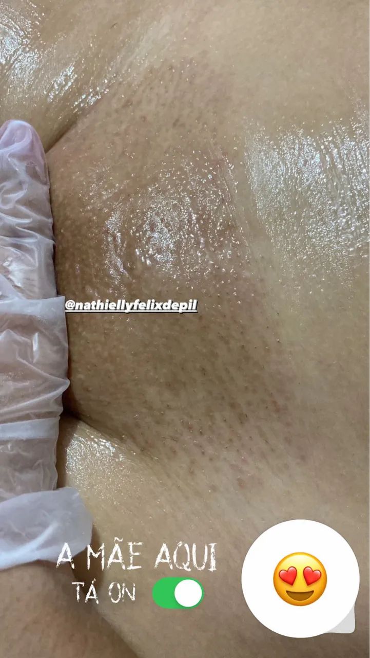 Depilação  SOMENTE FEMININA  - Foto 3