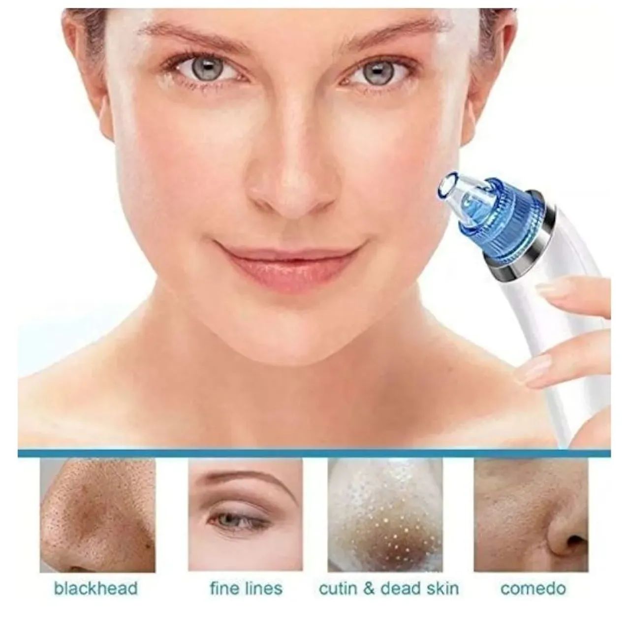 Aparelho limpeza facial/removedor cravos e espinhas