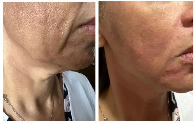 Mentoria de Formacao em Estetica Avancada - Foto 4