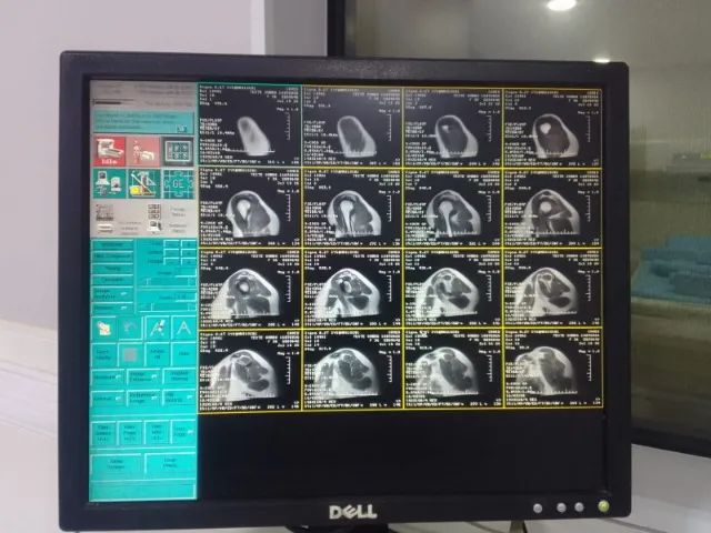 RESSONANCIA MAGNETICA GE ABERTA - Foto 3