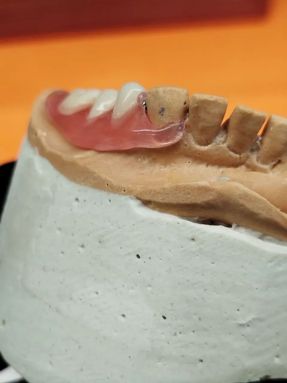 Prótese dentaria  - Foto 4