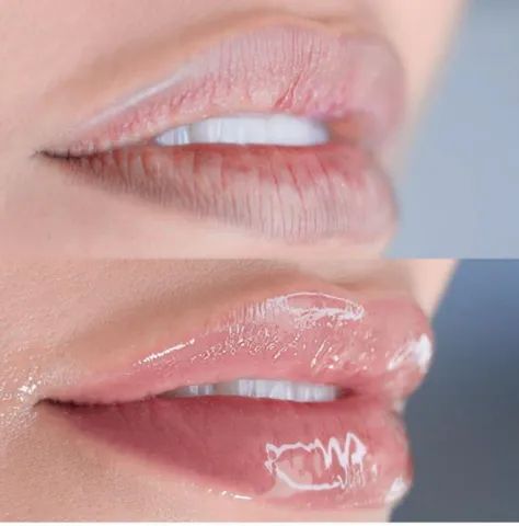 Hidragloss / hidralips - Foto 2