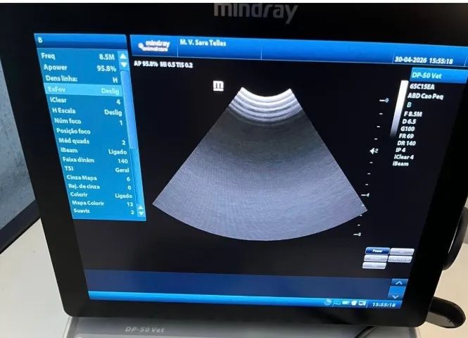 Ultrassom 
