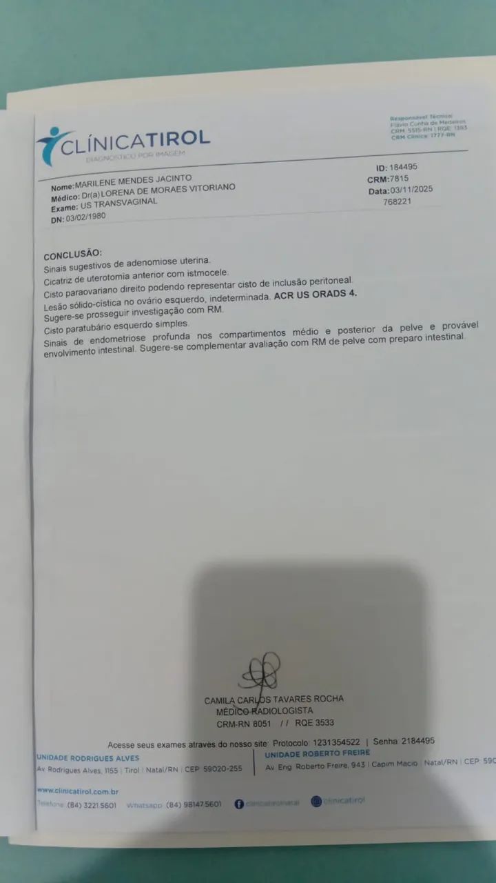 Cadeira fixa sem braços na lateral  - Foto 5