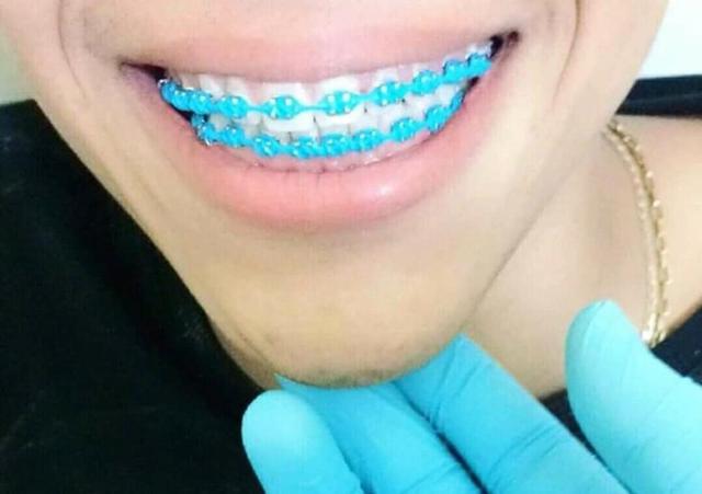 Aparelho Dental - Foto 3