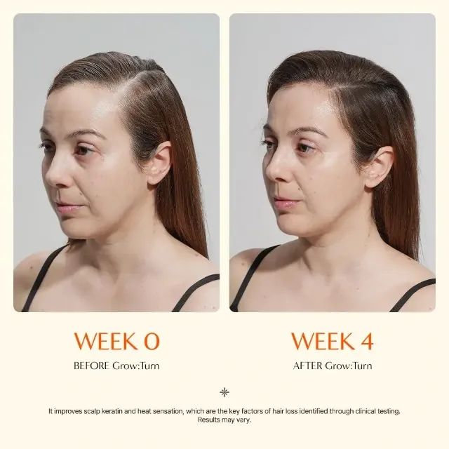 Grown Turn Ampoule Lilyeve Tratamento Capilar Coreano - Foto 2