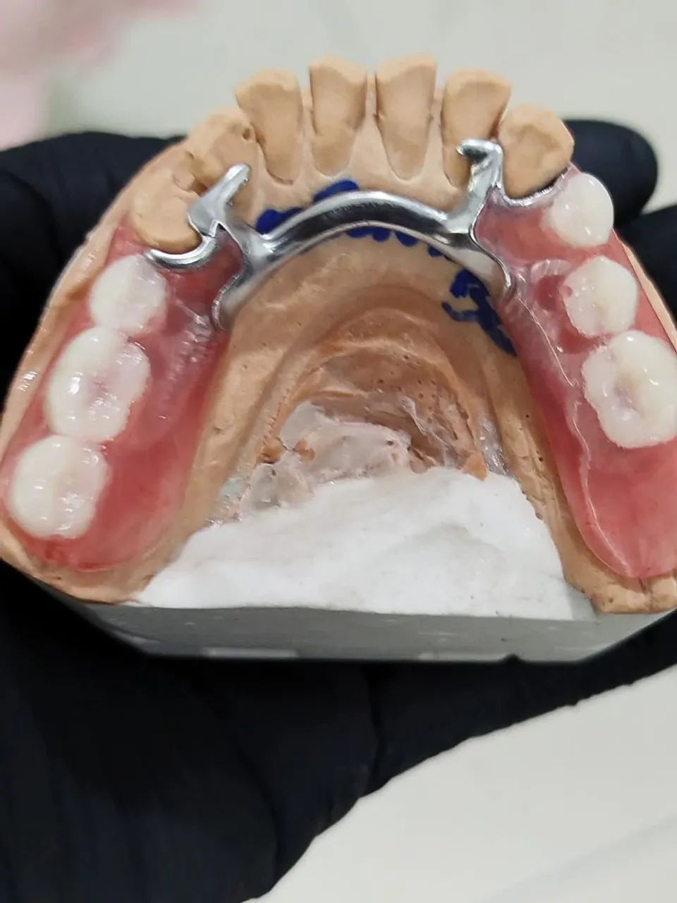 Prótese dentaria  - Foto 5