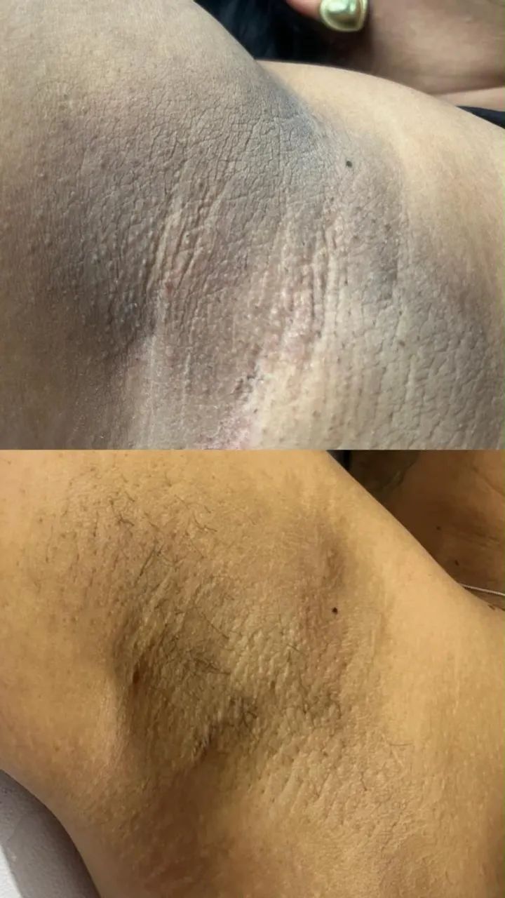 ESTETICISTA (CLAREAMENTO FACIAL/CORPORAL) - Foto 3