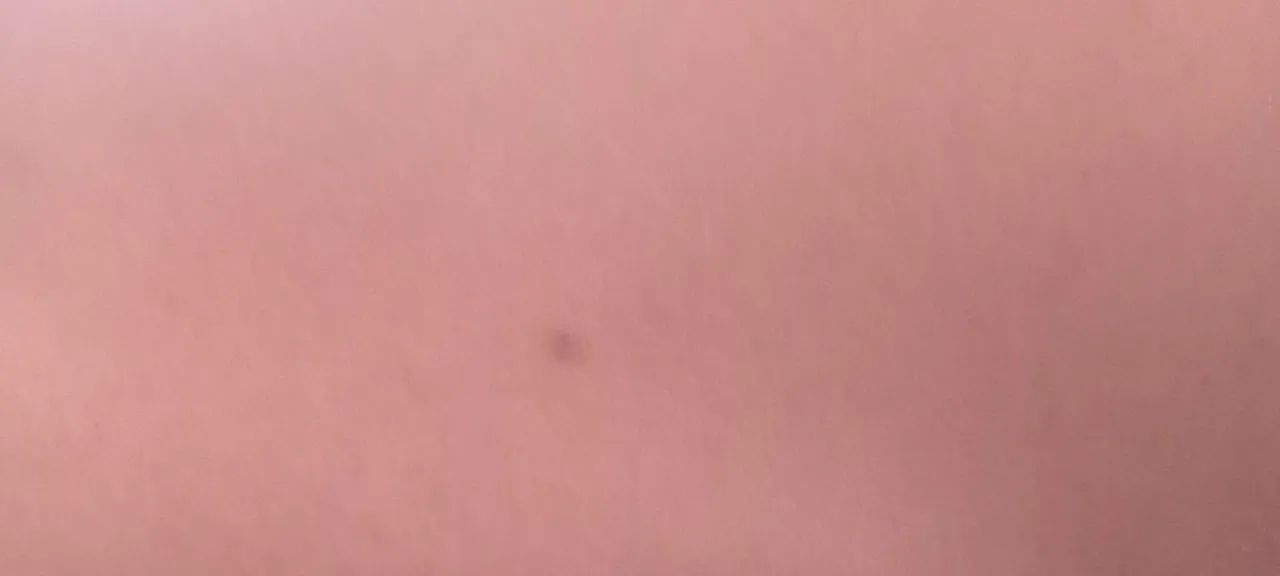 Factor 125 - Foto 3
