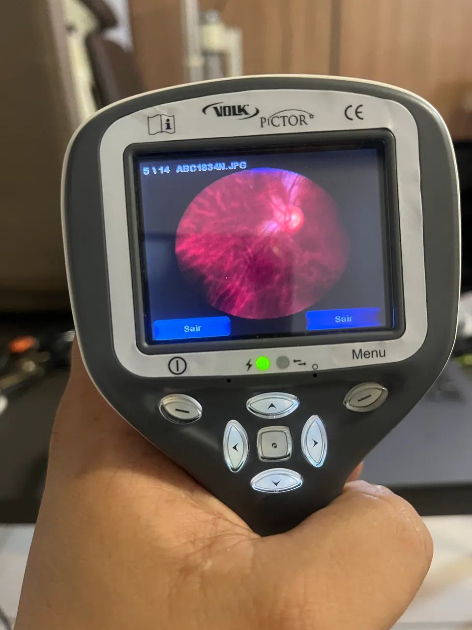 Retinografo portátil  - Foto 4