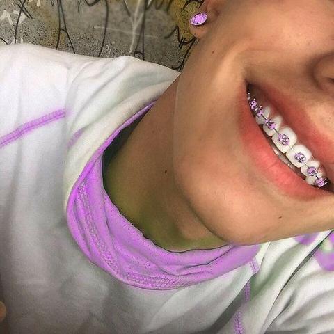 Aparelho Dental