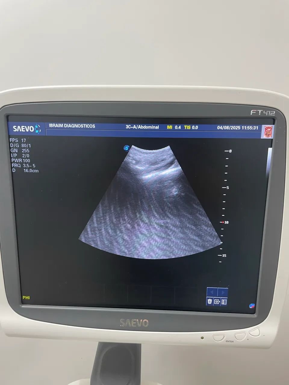 Ultrassonografia Saevo FT412 - Foto 3
