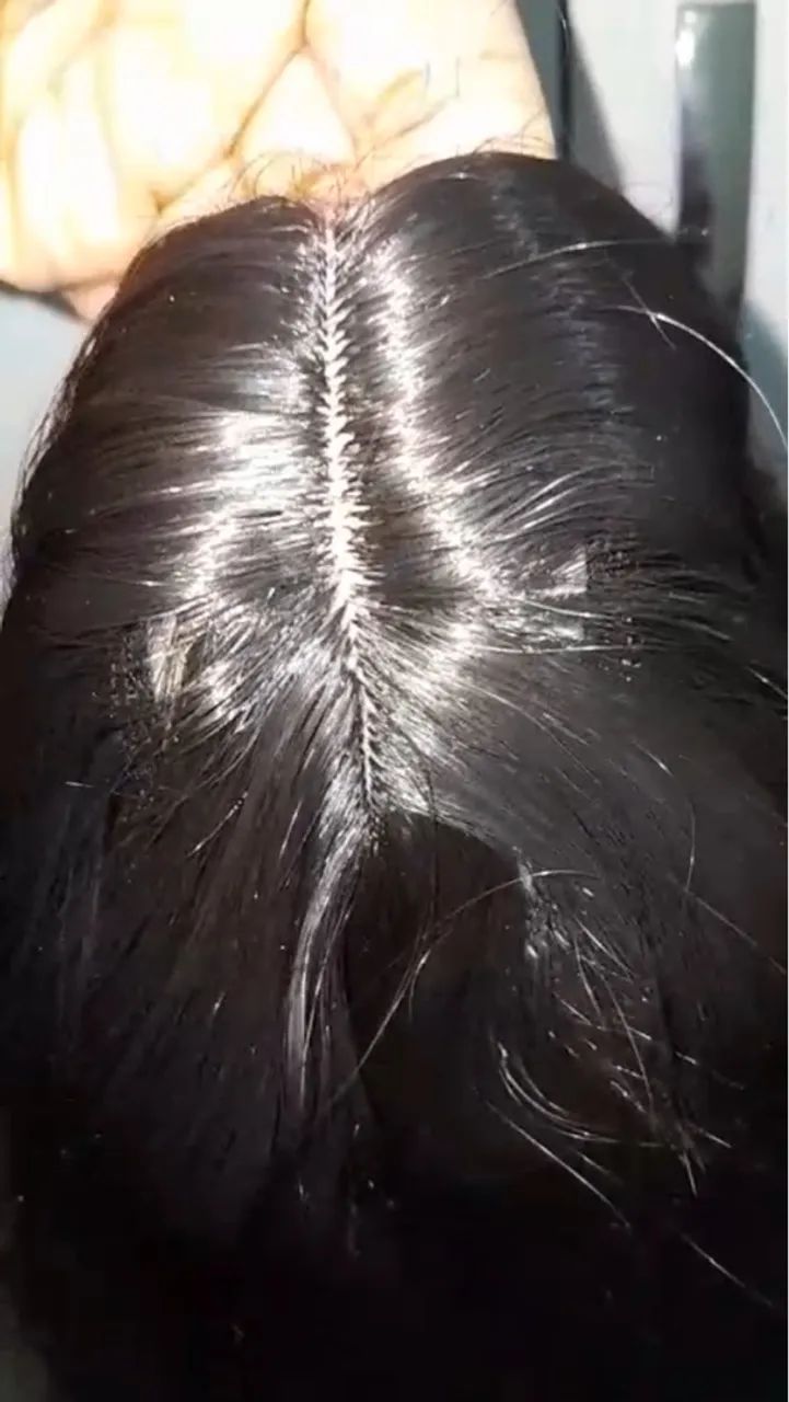 VENDO LACE URGENTE -Cabelo Sintético - Foto 3