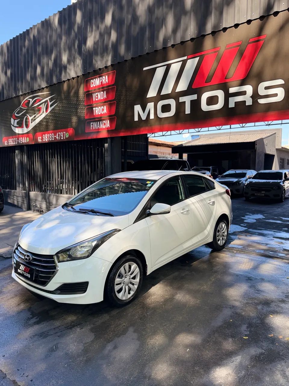 Hyundai Hb20S 2018