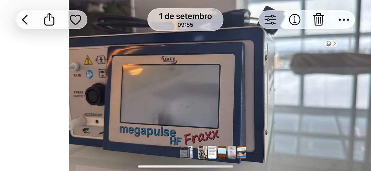 Radiofrequencia