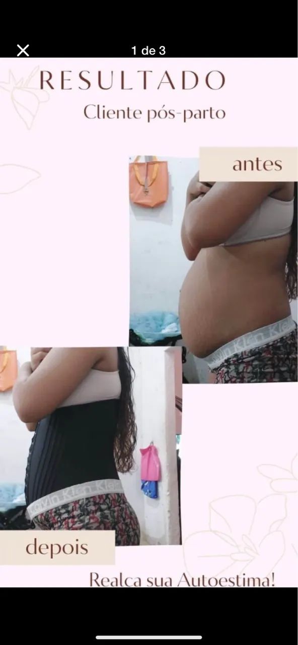 Modeladora redutora 20 Hastes uso pós parto