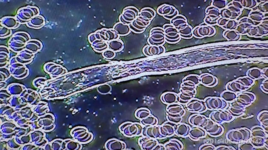Microscopio de campo escuro  - Foto 4