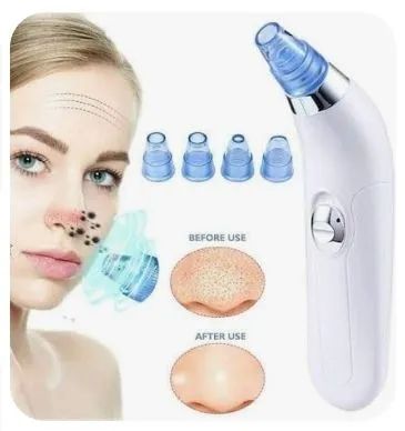 Aparelho limpeza facial/removedor cravos e espinhas - Foto 3