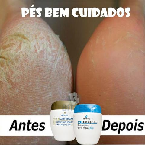 Creme Pés Parapes Hidratante Afinar Tratamentos Calosidades Natubelly Cosméticos - Foto 3