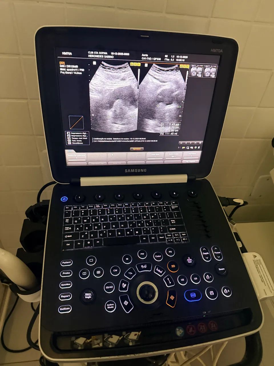 Aparelho de Ultra Sonografia HM70A - Foto 4