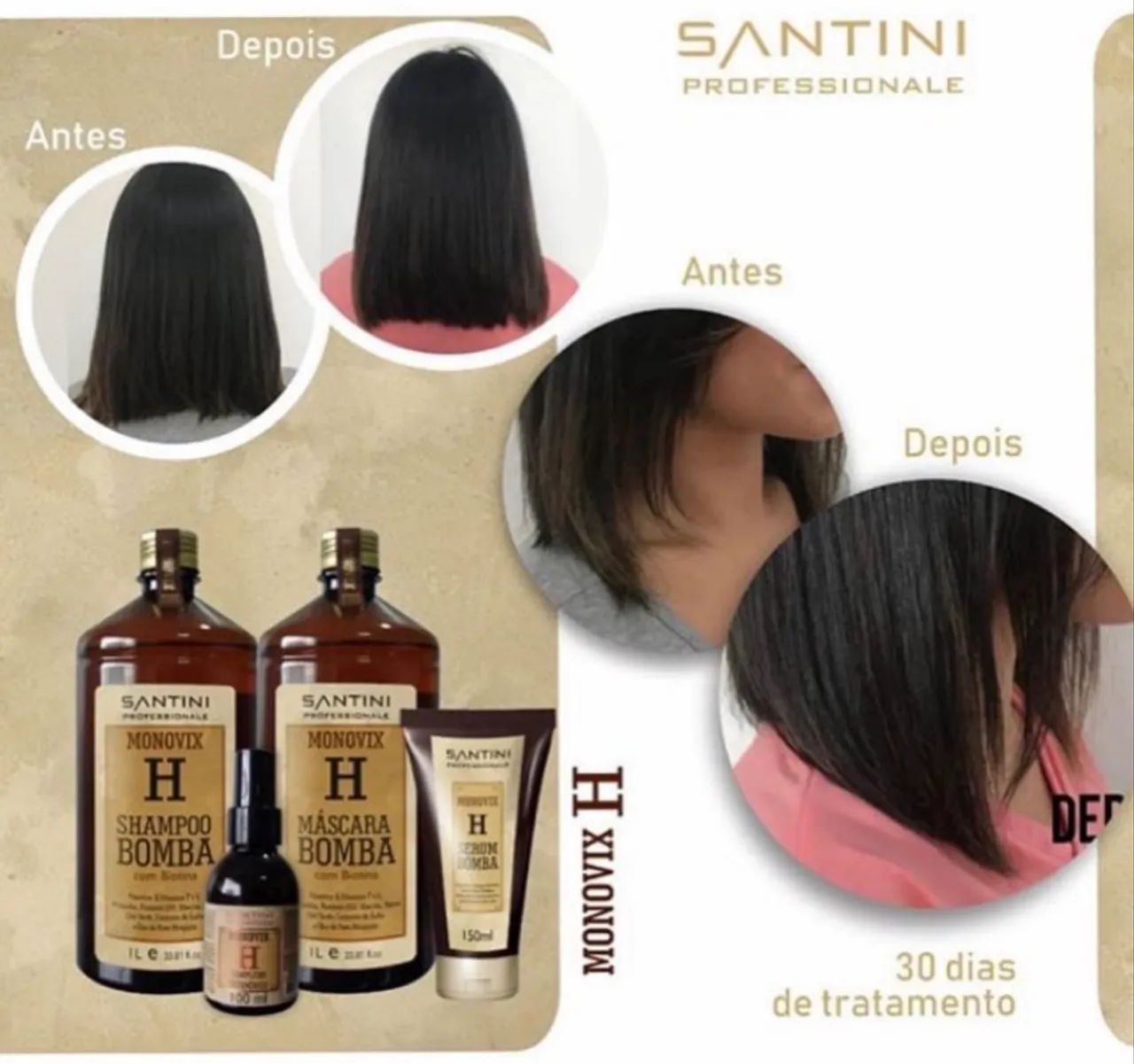     CABELO CAINDO, FRACO E SEM CRESCER? O KIT BOMBA É PRA VOCÊ! - Foto 3