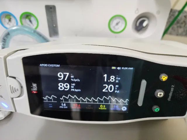 Oximetro Masimo Radical-7 - Foto 4