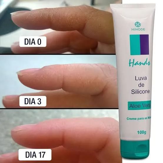 Luva de Silicone Hands Hinode Aloe Vera - Foto 4