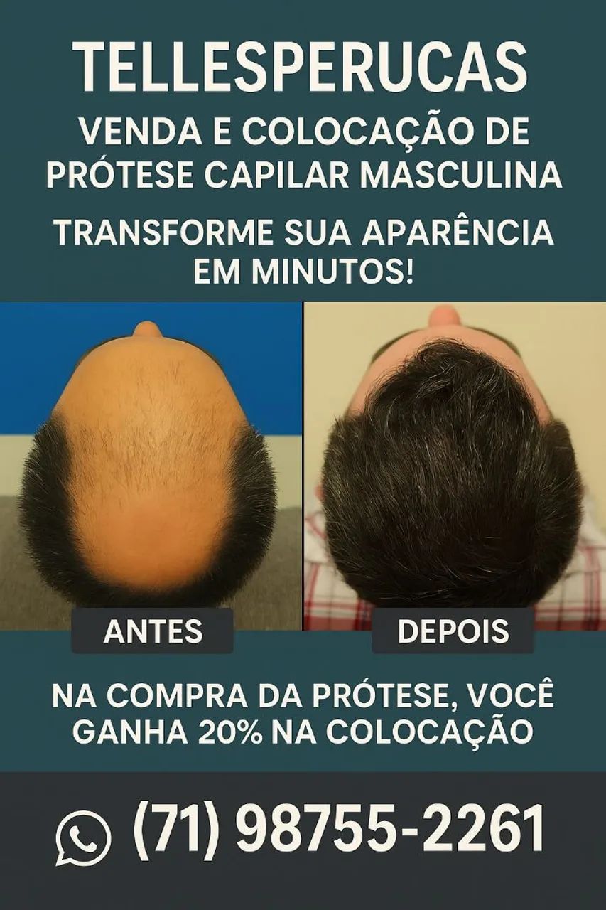 Prótese Capilar Masculina - Tellesperucas