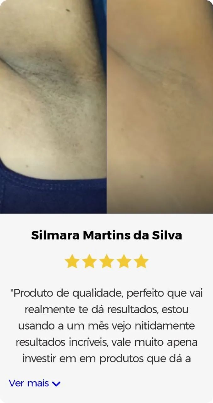 Clareador CC Cream Intimo - Foto 3